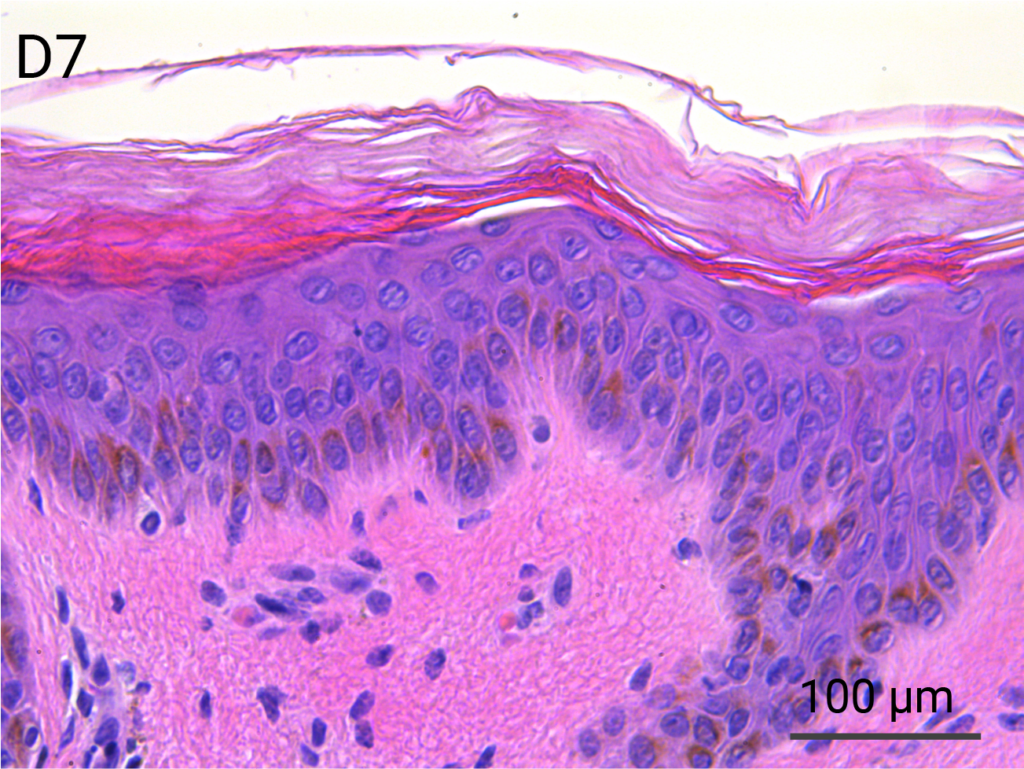 HypoSkin Injectable Ex Vivo Skin Model Genoskin