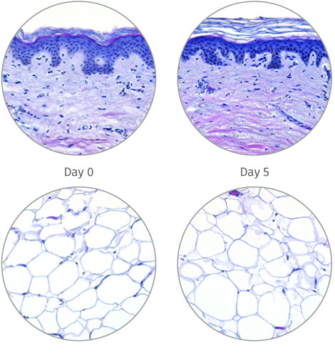 human skin model for subcutaneous 