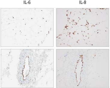 Photos showing the scoring of IL-6 and IL-8 mRNA expression in skin before and after treatment with a pro-inflammatory cocktail