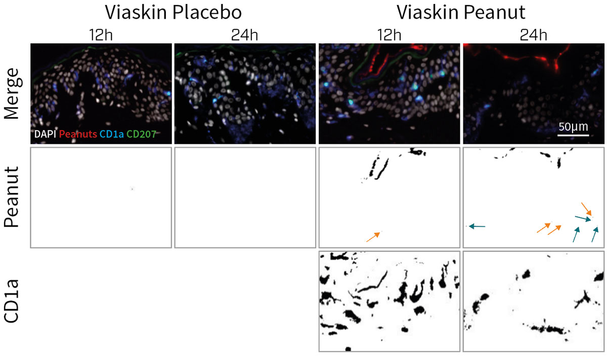 Graphics showing allergen penetration and colocalization with Langerhans cells on tissue sections