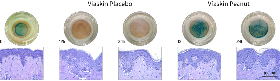 Skin biopsies photos and histology. Macroscopical and histological evaluation of tissue integrity during treatment