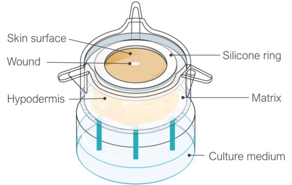 Illustration of Woundskin model