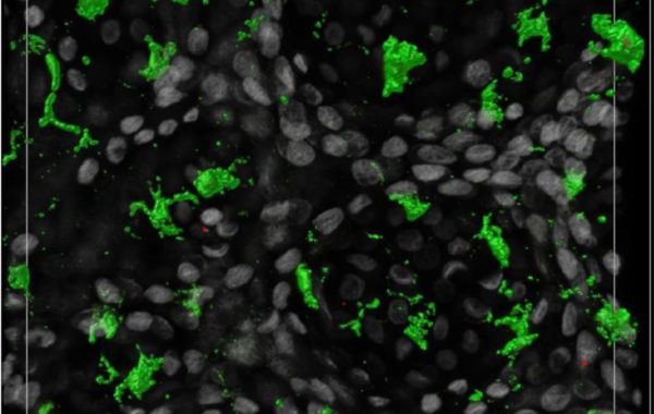 Photo illustrating NativeSkin publications: immunostaining of treatment with via skin