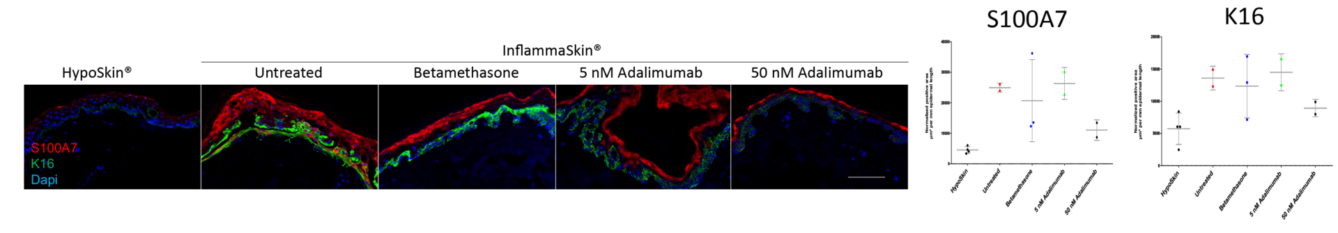 Anti-100A7/K16 double immunofluorescence staining showing how InflammaSkin® reacts to adalimumab