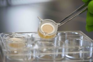 Genoskin's ex vivo human skin assay, HypoSkin®. An alternative method to animal testing for FDA approval 