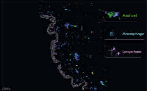 Immune cells in NativeSkin multiplex imaging