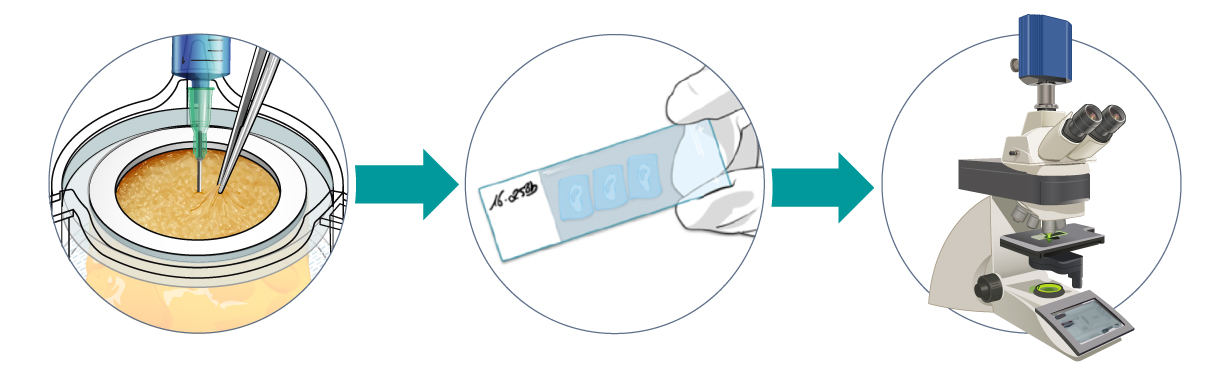 Injection Site Reaction Workflow