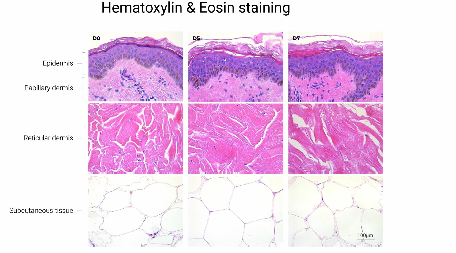 HypoSkin, epidermis, dermis and subcutaneous tissue integrity at seven days