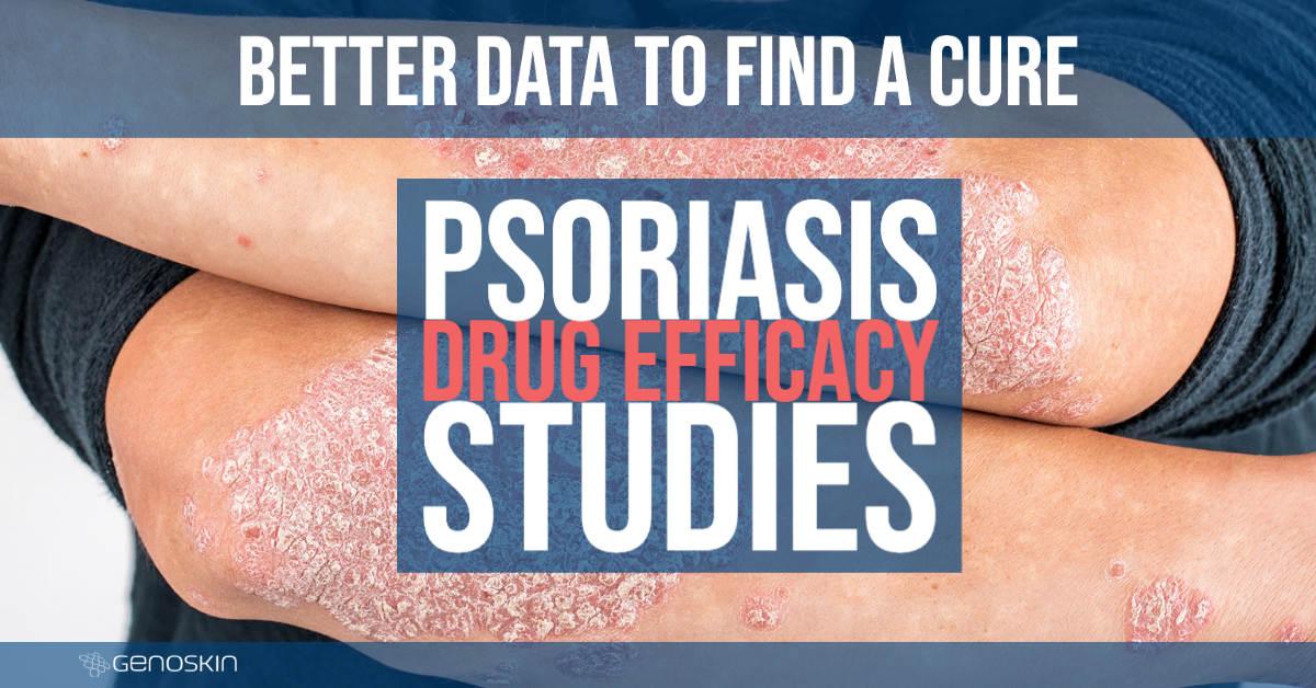 latest research in psoriasis