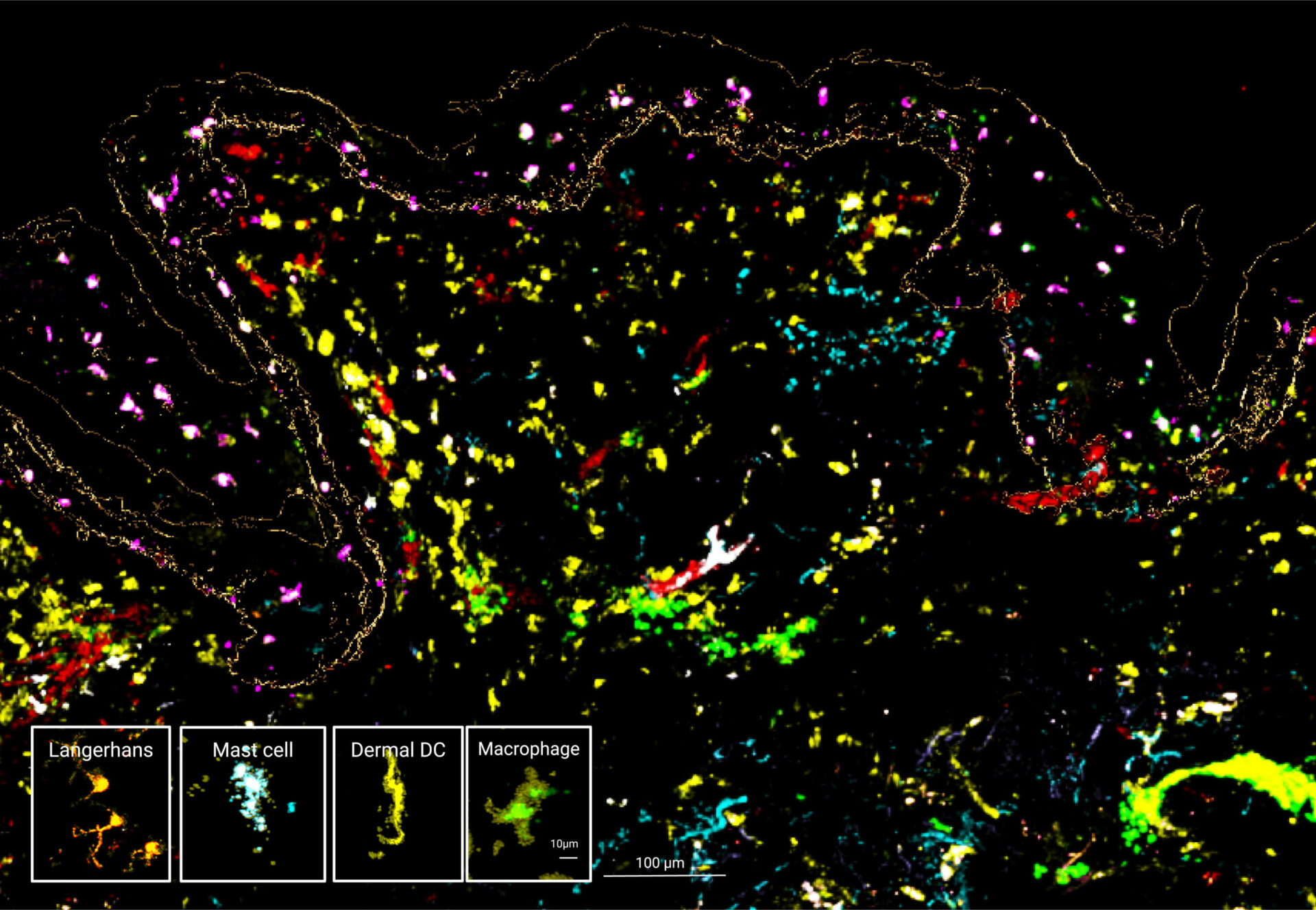 Mantis spatial biology image of human skin immune cells