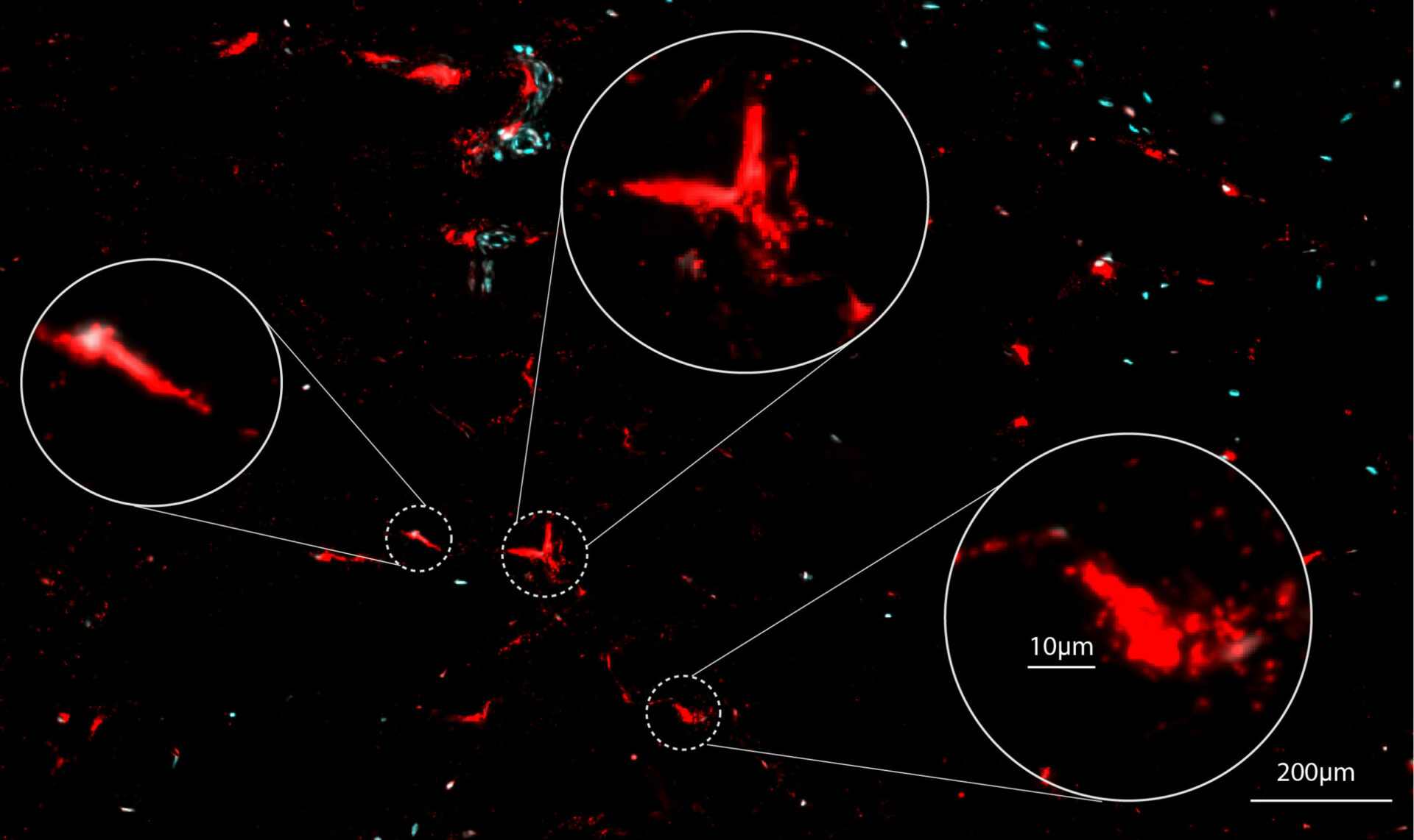 Mast cells degranulation zoom in - zoom out Mast cells degranulation zoom in - zoom out