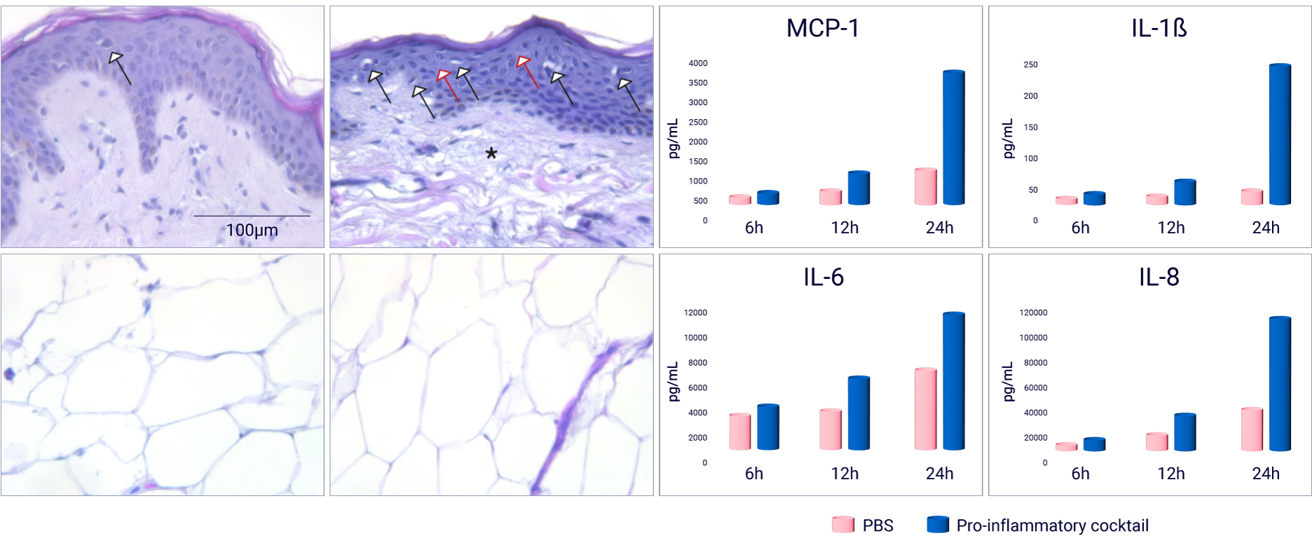 Histology photos and graphics showing local inflammatory reactions