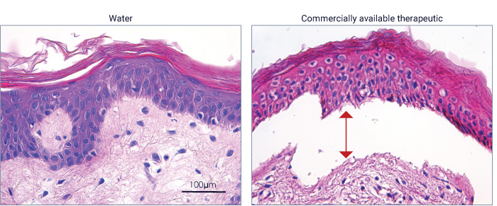 Assess tissue integrity with HE staining. Local tolerance studies on ex vivo human skin models with Genoskin