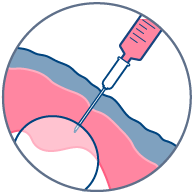 Bolus injection Bolus injection