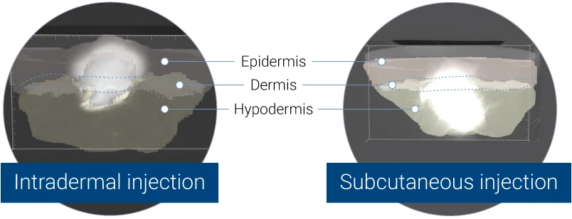 3D representation acquired by X-ray tomography, showing the bolus in the dermis (left panel) or in the hypodermis (right panel).