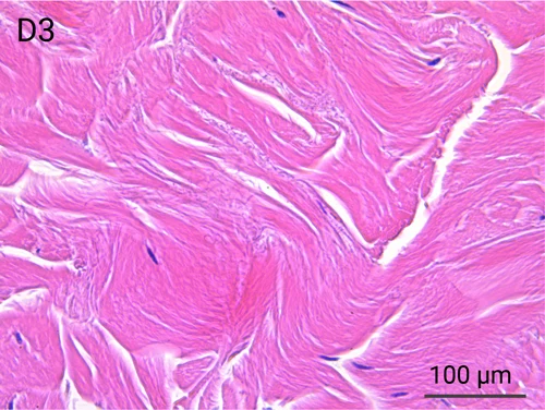 HypoSkin Reticular Dermis - Day 3