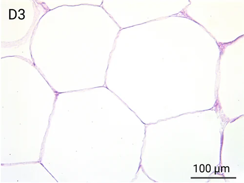 HypoSkin Subcutaneous tissue - Day 3