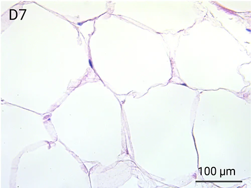 HypoSkin Subcutaneous tissue - Day 7