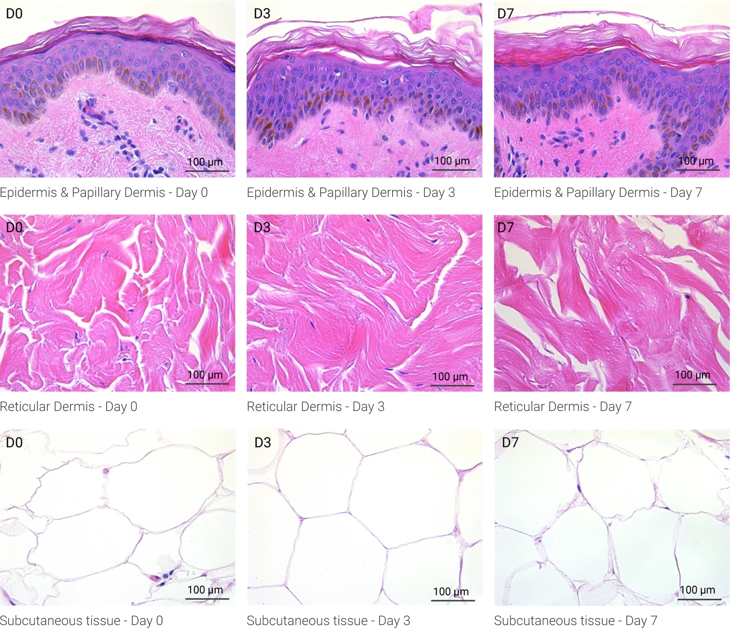 Structural biostabilization