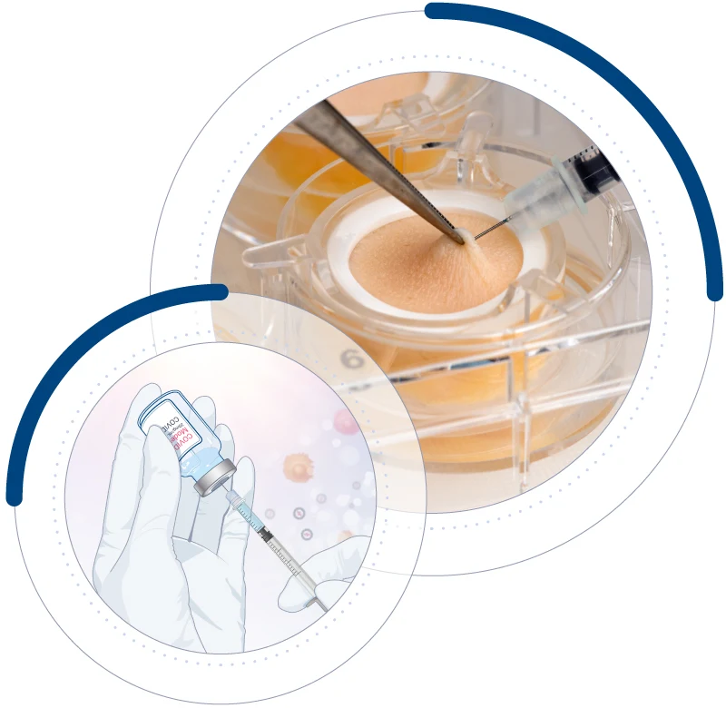 HypoSkin, injectable human skin model made from real human skin tissue samples and designed to study human response to biologics and other therapies