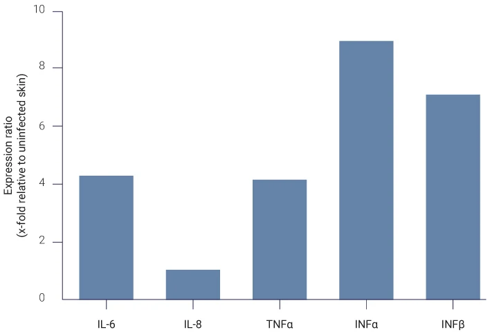 Analysis of pro-inflammatory cytokines (IL-6, IL-8, TNFα, INFα, INFβ) expression by qPCR on total skin lysates.