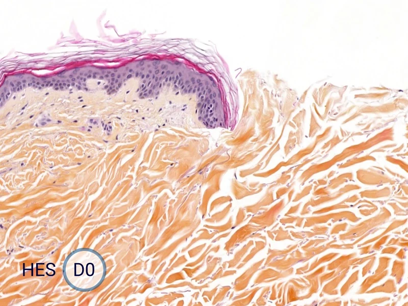 HES (Hematoxylin-Eosin-Safran) shows the progression of the epithelial tongue