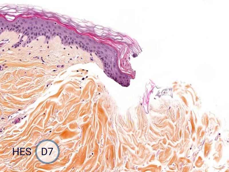 HES (Hematoxylin-Eosin-Safran) shows the progression of the epithelial tongue