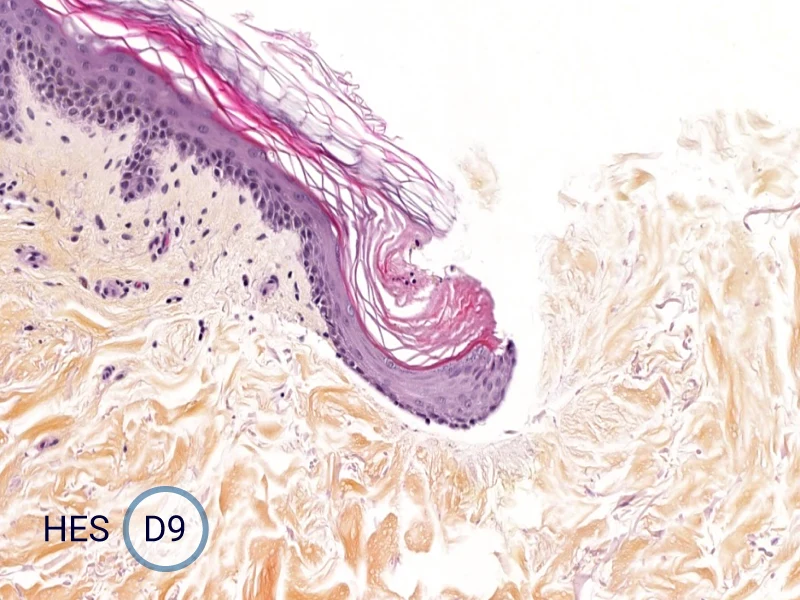 HES (Hematoxylin-Eosin-Safran) shows the progression of the epithelial tongue