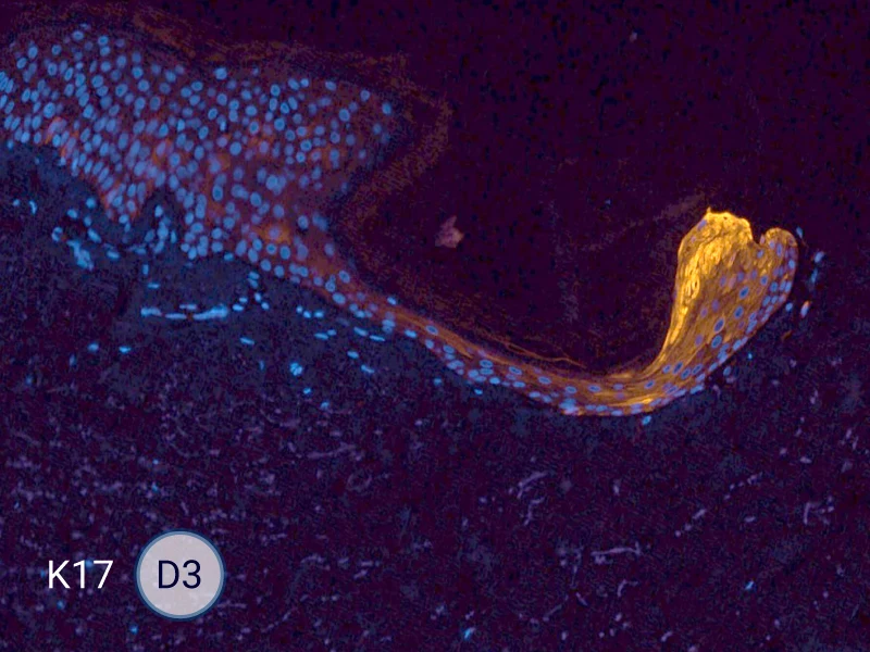 K17 specific marker of keratinocytes migrating over to wound bed