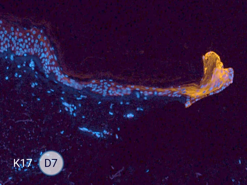 K17 specific marker of keratinocytes migrating over to wound bed