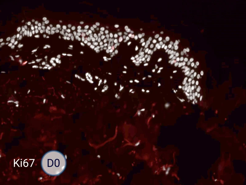 Ki67 cells in the epithelial tongue are proliferating