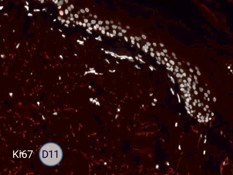 Ki67 cells in the epithelial tongue are proliferating