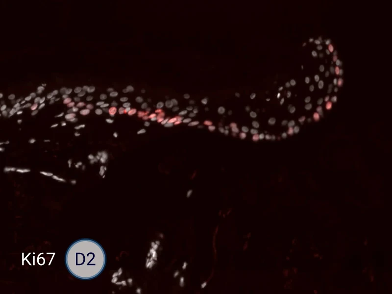 Ki67 cells in the epithelial tongue are proliferating