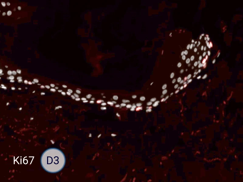 Ki67 cells in the epithelial tongue are proliferating