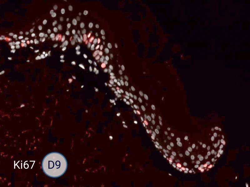 Ki67 cells in the epithelial tongue are proliferating