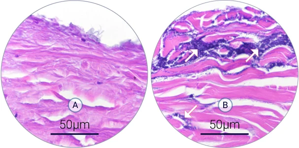 Hematoxylin and eosin staining shows the structure of the wound (dermis in pink) and bacteria (dark purple). A S. aureus biofilm developed over 4 days of infection in the wound.