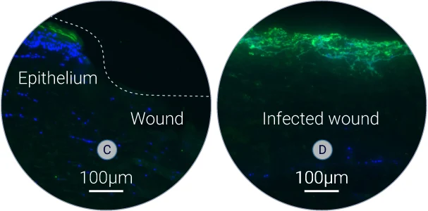 S. Aureus was detected on tissue sections by using a specific antibody. High level of green fluorescence indicates the presence of S.aureus within the wound.