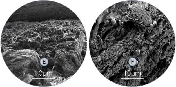 Scanning electron microscopy analysis shows presence of bacteria among collagen fibers.