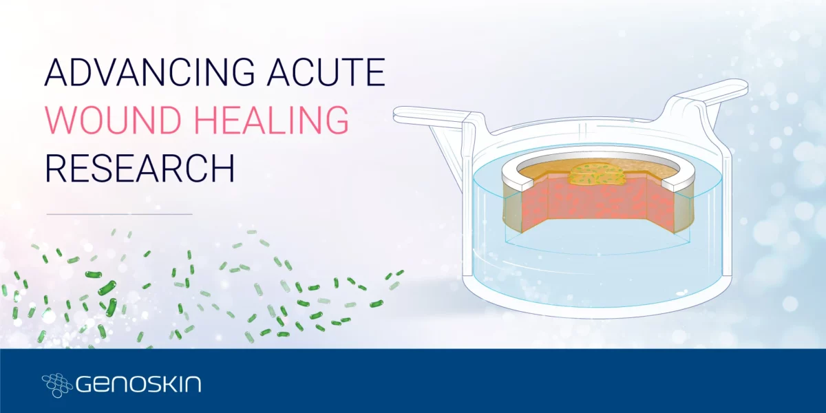 Advancing acute wound healing research