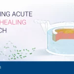 Advancing acute wound healing research