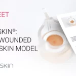 WoundSkin unique wounded human skin model