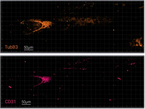 Characterization of immune cells and nerve endings Structural and activation markers analysis performed on a tissue cryosection with a thickness of 40µm: DAPI (nucleus), CD45 (immune cells), Tubulin β3 (nerve endings), CD31 (blood vessels)