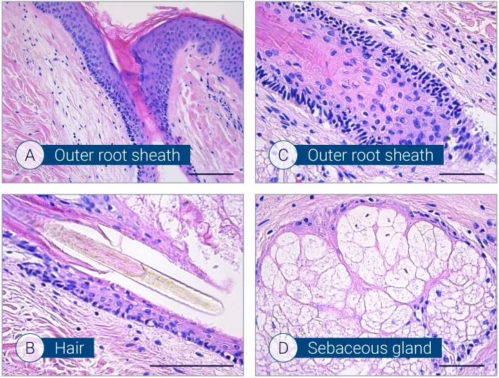 Hair follicle characterization H&E staining showing characterization of hair follicles on HairSkin models
