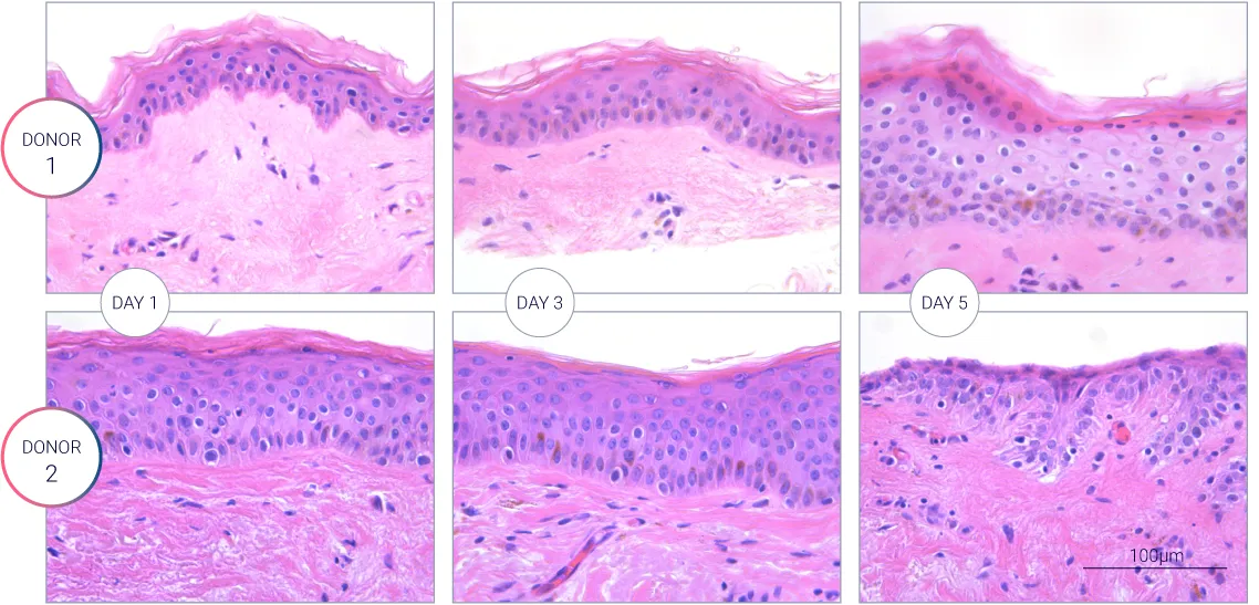Viability of the hair follicle H&E staining showing the hair follicle characterization during the culture. Viability of the hair follicle measured over 3 days for different donors