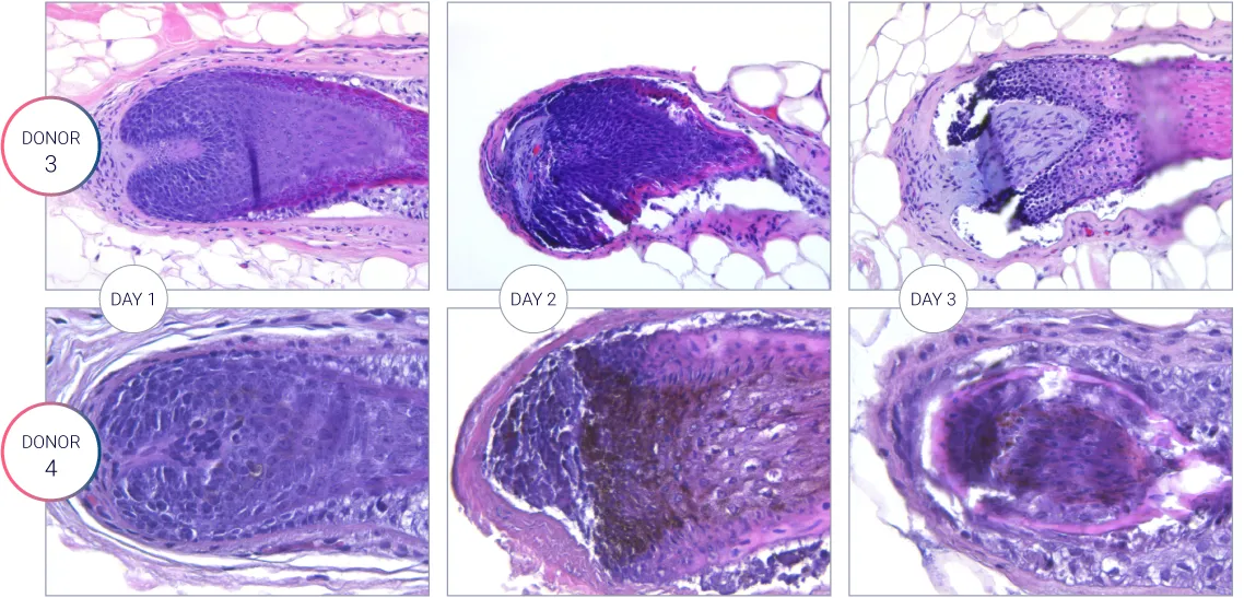 Viability of the hair follicle H&E staining showing the hair follicle characterization during the culture. Viability of the hair follicle measured over 3 days for different donors