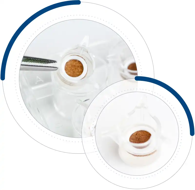 BreastSkin breast-specific ex vivo human skin model for cosmetic and dermatological research