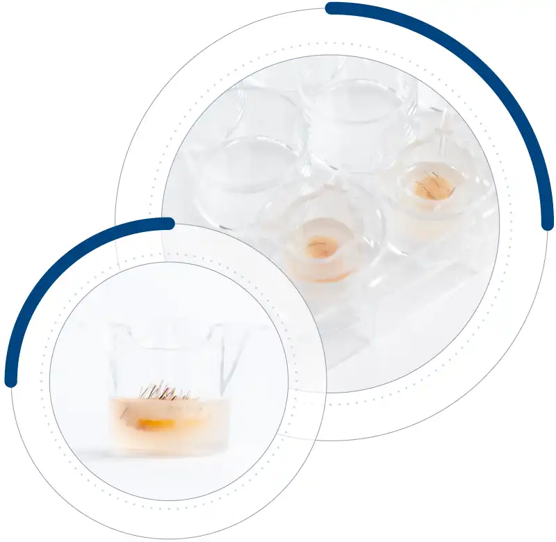 HairSkin follicle-rich human skin model for hair and scalp research